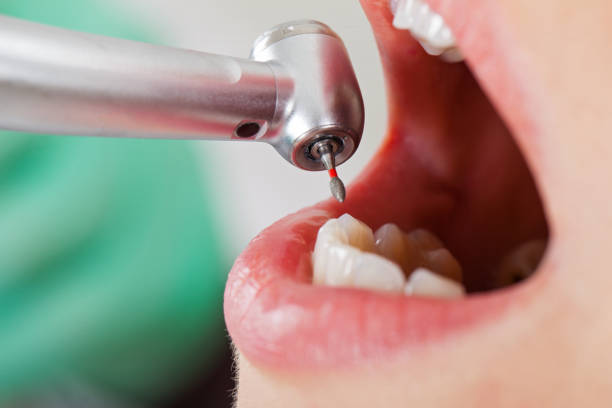 Best Pediatric Emergency Dentist in Experiment, GA